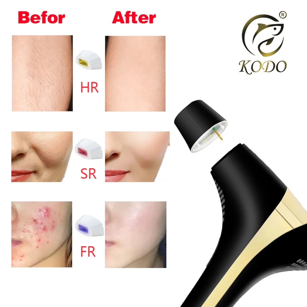 KODO 2023 Nouvelle épilation laser en dropshipping, vente chaude, épilateur laser permanent IPL indo