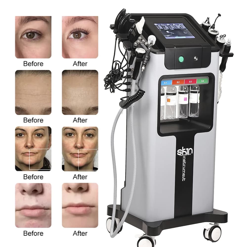 Missheart 10 en 1 eau oxygène Hydro Machine nettoyage en profondeur exfoliant gestion de la peau rég