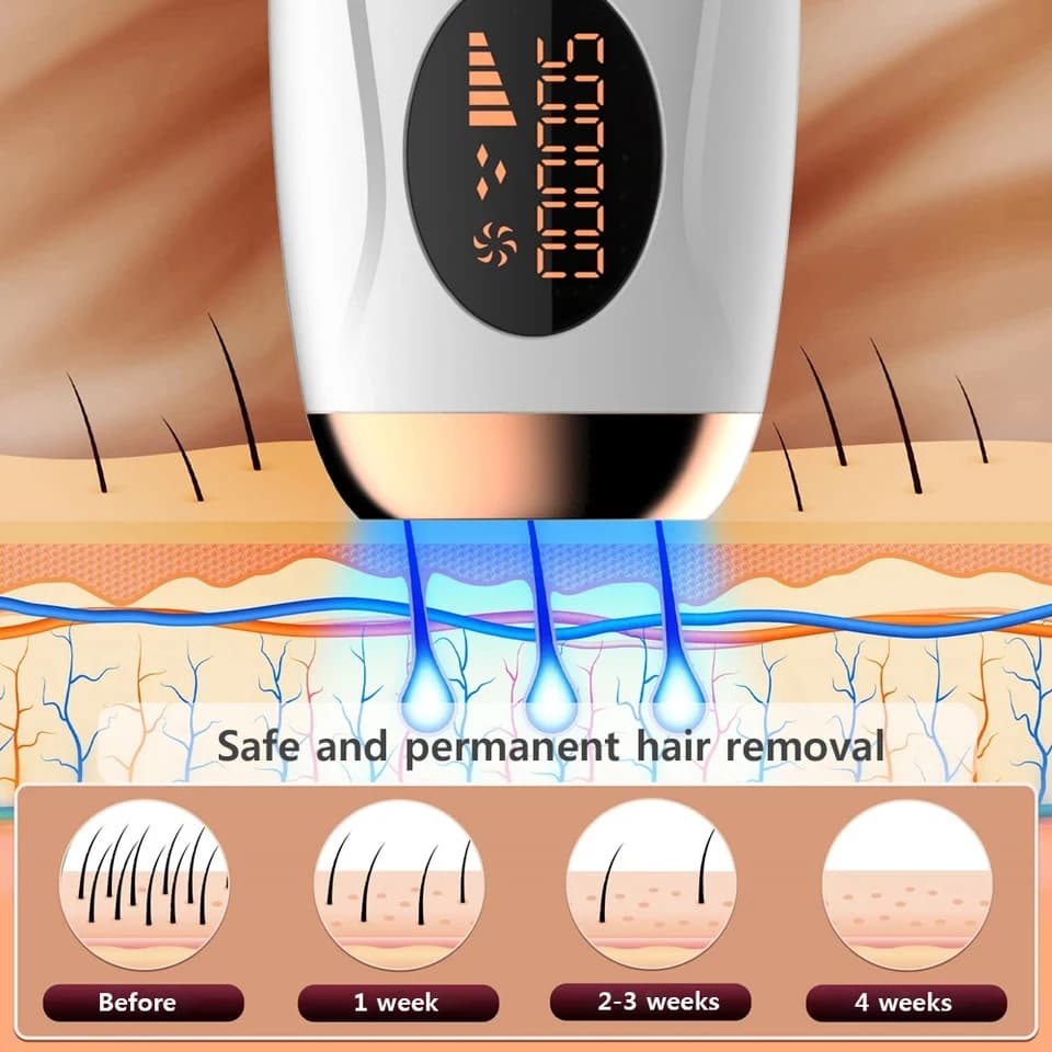 Épilateur laser IPL portable 999999   Flashes - Épilation indolore et permanente pour le corps et la
