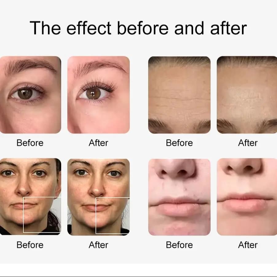 Hydro Machine à oxygène et eau 12 en 1, Lifting du visage, nettoyage en profondeur, Dermabrasion, Pe