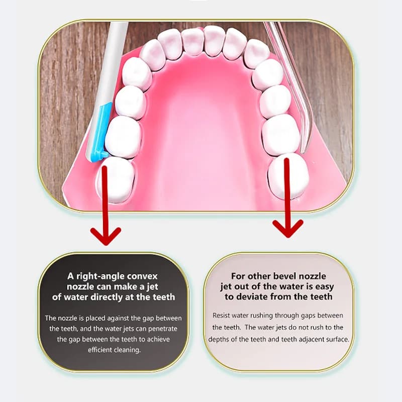 Irrigateur Chevdentaire à l'eau, fil dentaire, cure-dents, d'argile buccale, livres de dents, machin