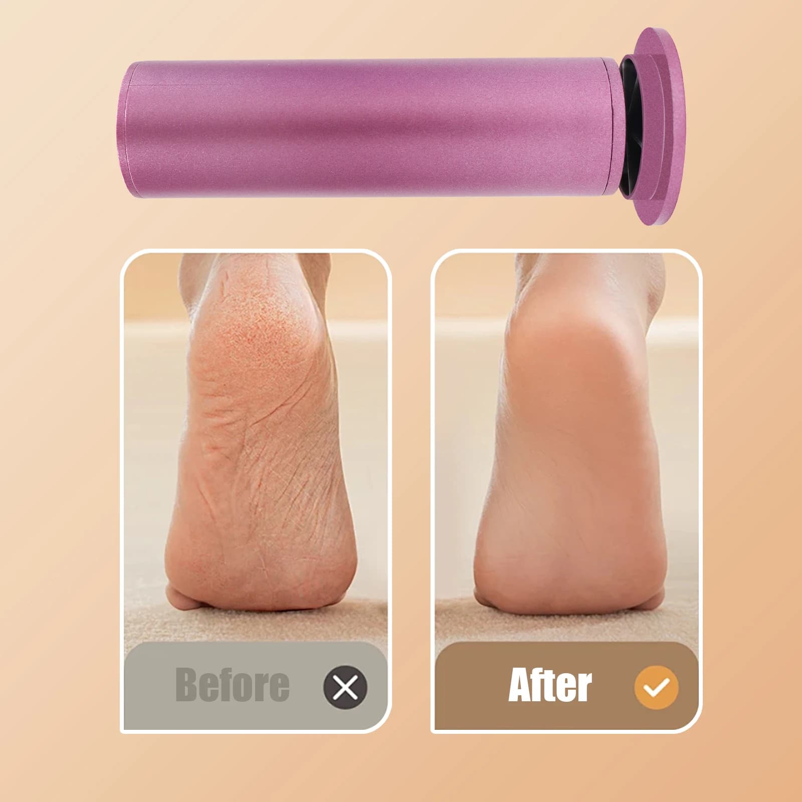 Dissolvant électrique de callosités des pieds à vitesse réglable, outil de pédicure, manucure, costu