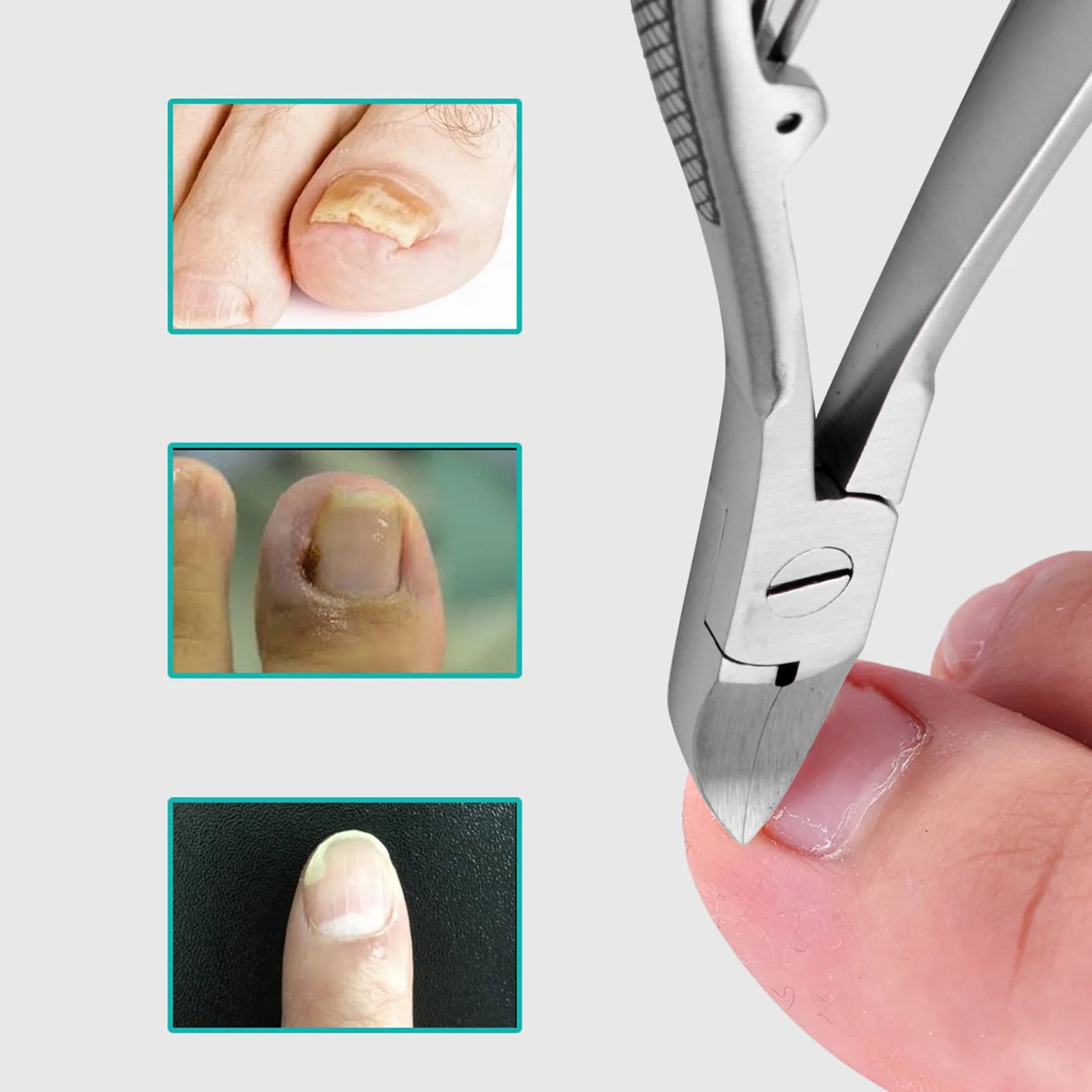Coupe-ongles professionnel en acier inoxydable, outils de soins des pieds